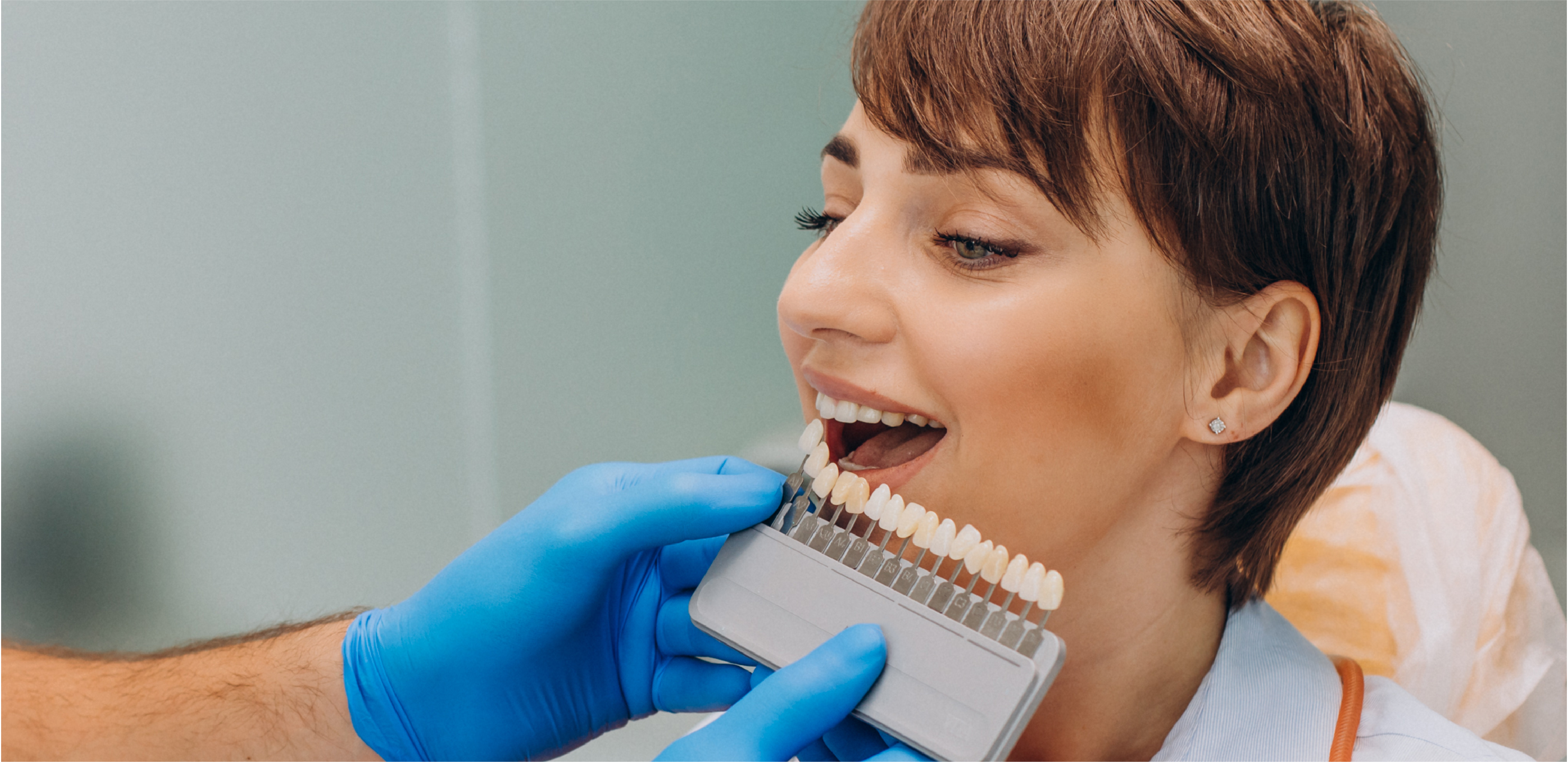 Porque deve fazer um branqueamento dentário?